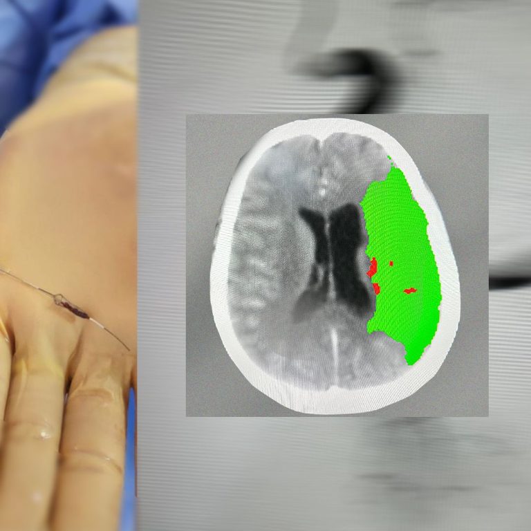 Medical device development